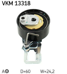 Spannrolle Zahnriemen für CITROËN FORD OPEL PEUGEOT TOYOTA DS BERLINGO